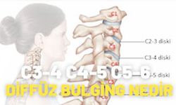 C3-4 C4-5 C5-6 Diffüz Bulging Nedir