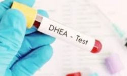 Dehidroepiandrosteron Sülfat Nedir