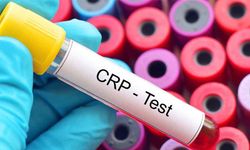 Crp Türbidimetrik Yüksekliği Nedir