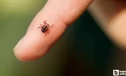 Kenelerden Korunmada Çorap ve Kıyafet Uyarısı