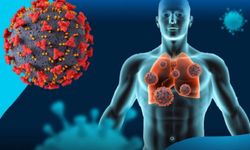 H3N2 Virüsü Yeniden Türkiye’de! Kışa Solunum Alarmıyla Girdik