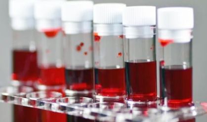 Kalp Krizi Riskinde Kan Grubu Faktörü: Araştırmalar Hangi Grubu İşaret Ediyor?