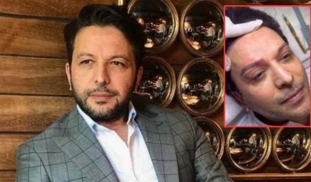 Nihat Doğan Estetik Yaptırdı! Son Halini Görenler İnanamadı
