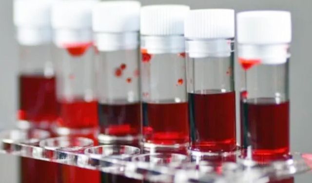 Kalp Krizi Riskinde Kan Grubu Faktörü: Araştırmalar Hangi Grubu İşaret Ediyor?