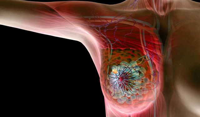 Yozgatlı Kadınlar İçin Uyarı: Kanseri Atlatan Ruh da Tedavi İster!