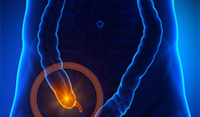 Yozgat’ta Sıklıkla Görülen Apandisit Hastalığı Hakkında Bilgiler