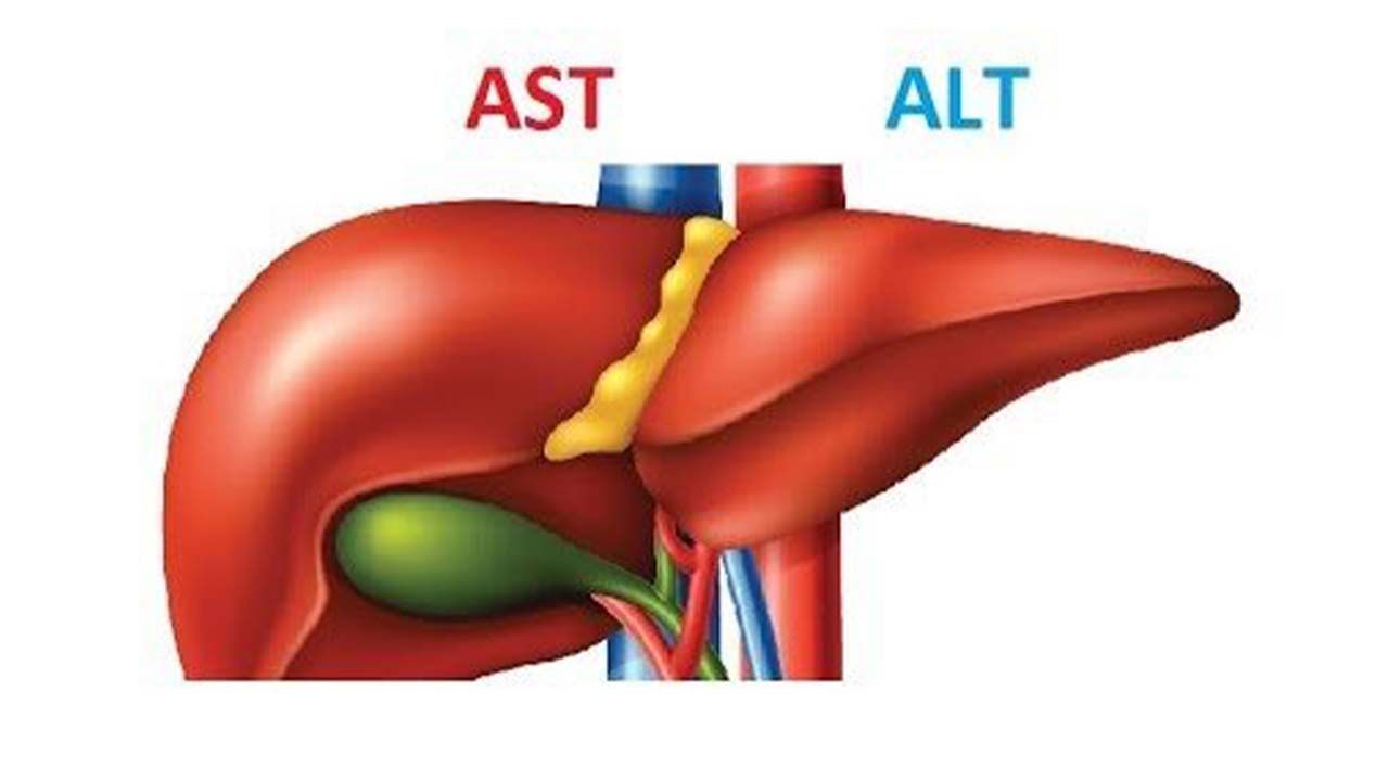 Alt (2)