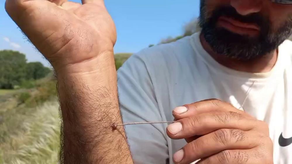 Kene Uzman Kırsal (2)