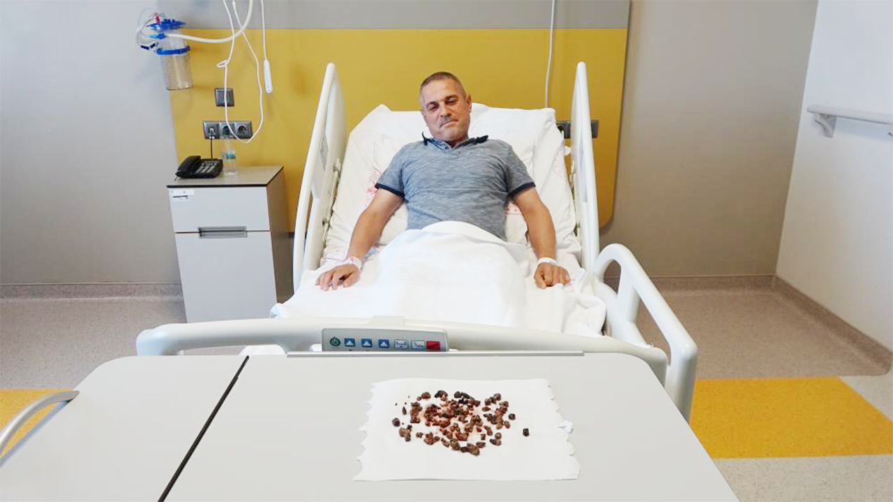 Şehir Hastanesi Böbrek Taşı (4)