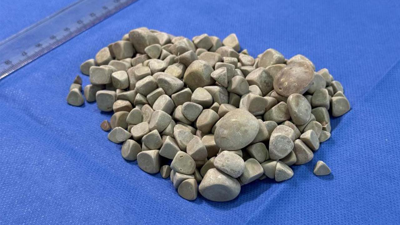 287 Taş Çıktı (3)