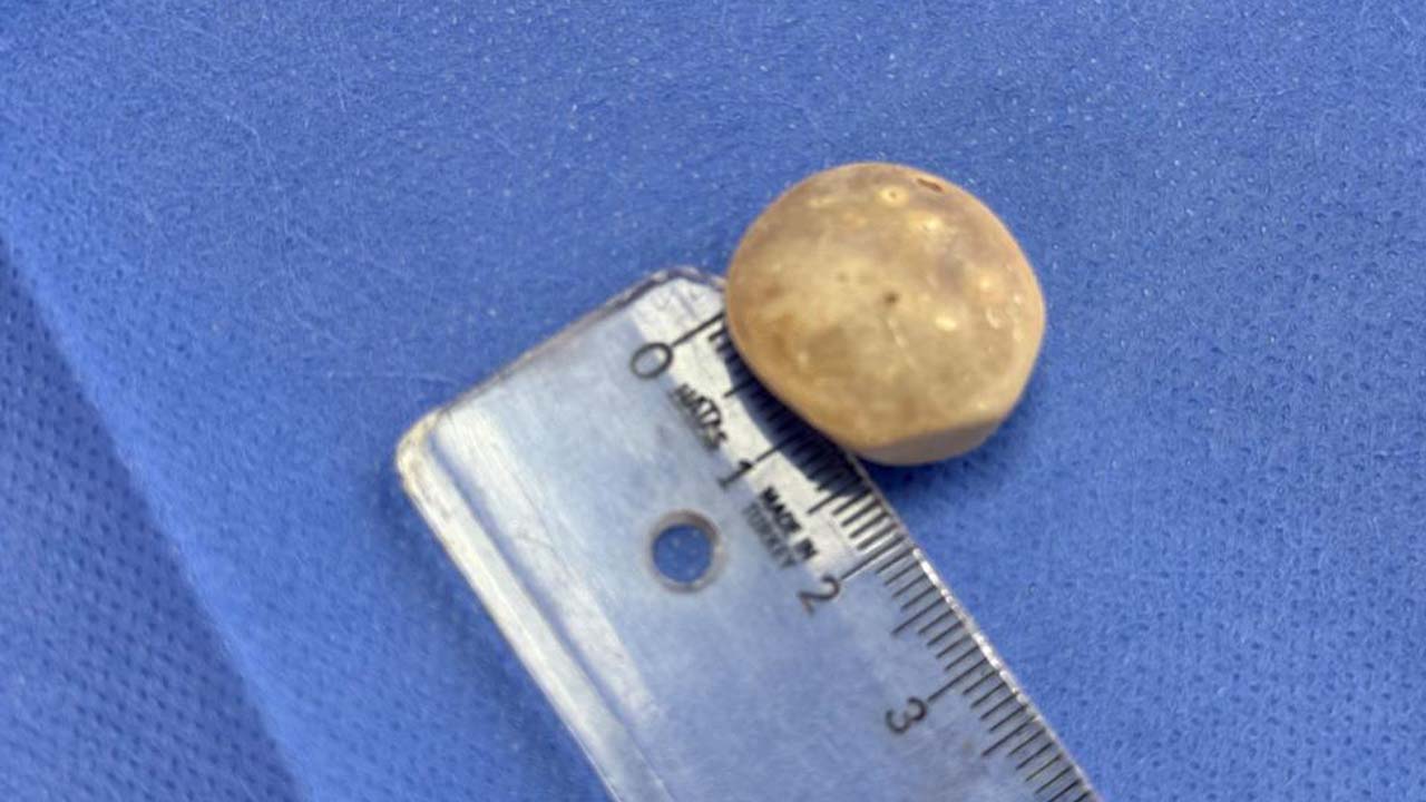 287 Taş Çıktı (4)