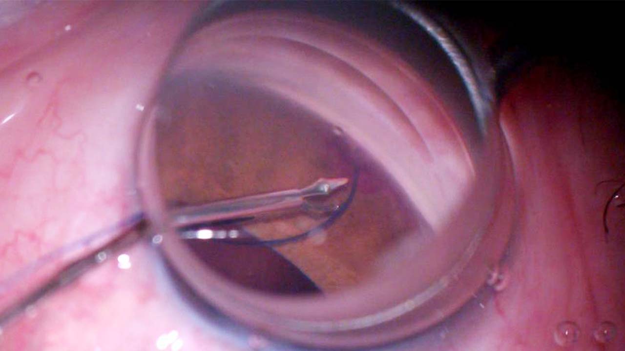 Şehir Hastanesi Göz (1)