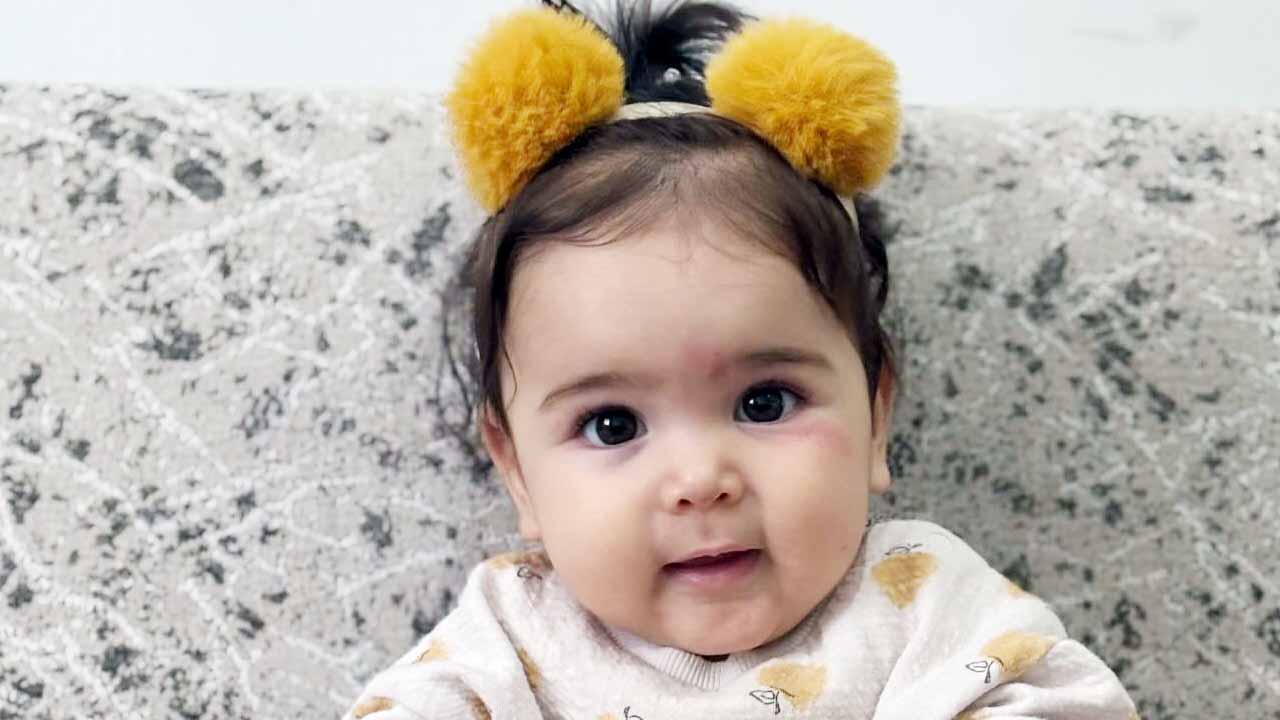 Alya Bebek Yardım Bekliyor Sma1